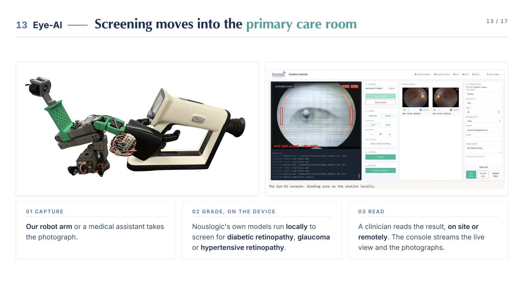 The Eye-AI Screening system